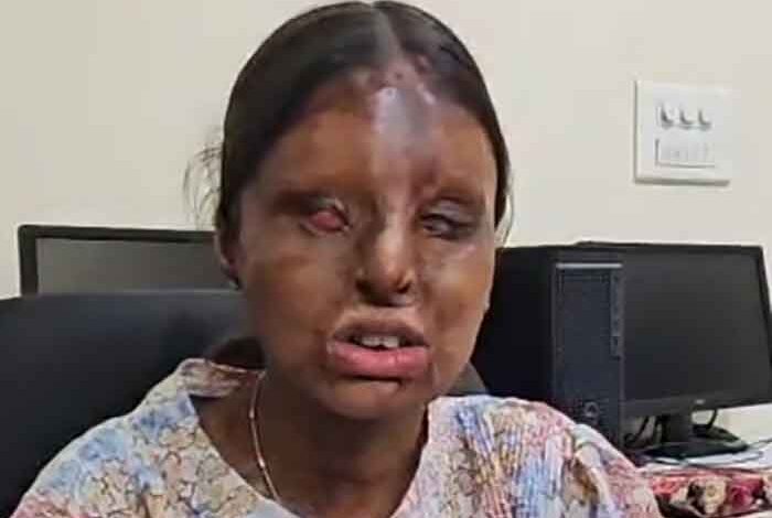 Tragedy into triumph: Chandigarh acid attack survivor scores 95.6 pc in CBSE Class 12 Tragedy into triumph: Chandigarh acid attack survivor scores 95.6 pc in CBSE Class 12